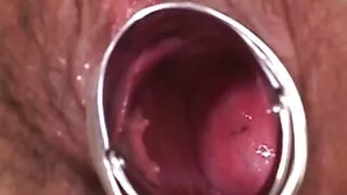 කෙල්ලගේ කටට කෙල උනනවා
